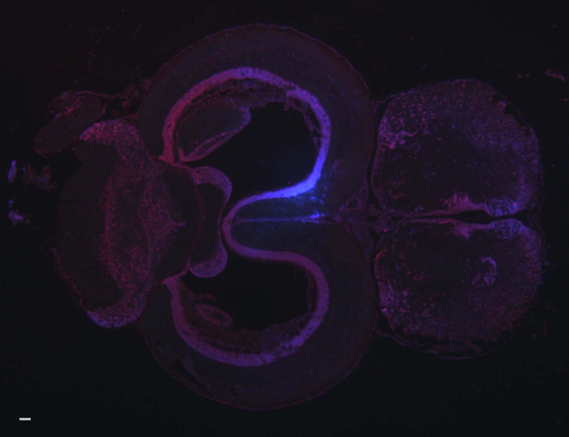 A fluorescent in situ hybridization on a thin slice of a threespine stickleback fish brain. Pink is where the probe can be found while blue labels individual cell nuclei.