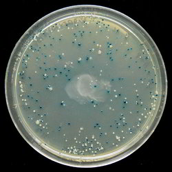A petri dish with growth media and small dots that are bacterial colonies growing on it. Some of the dots are white while others are blue.